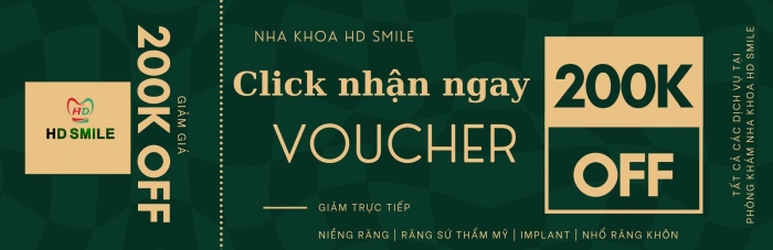 Voucher giảm ngay 200k khi sử dụng tất cả các dịch vụ tại Nha khoa HD Smile