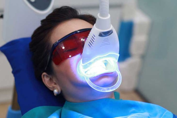 TẨY TRẮNG RĂNG LASER WHITENING